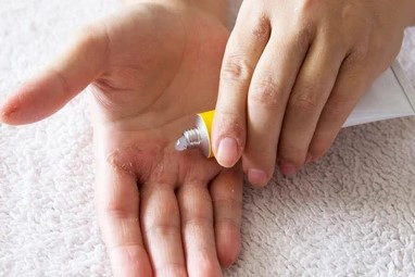 판테놀 연고 성분