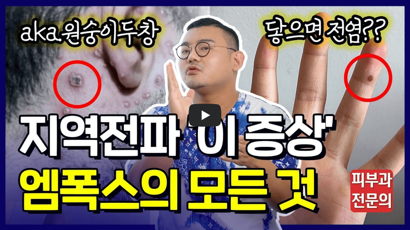 엠폭스 설명 영상 섬네일