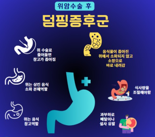 덤핑증후군 이미지