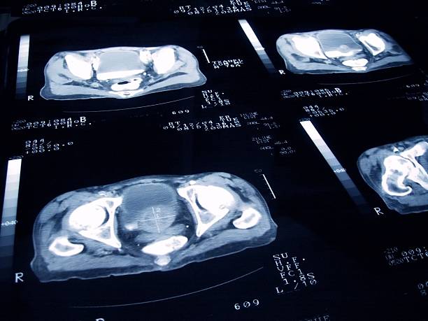 xray 사진