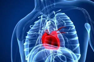 허혈성-심장질환