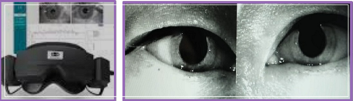 이석증-안진검사기