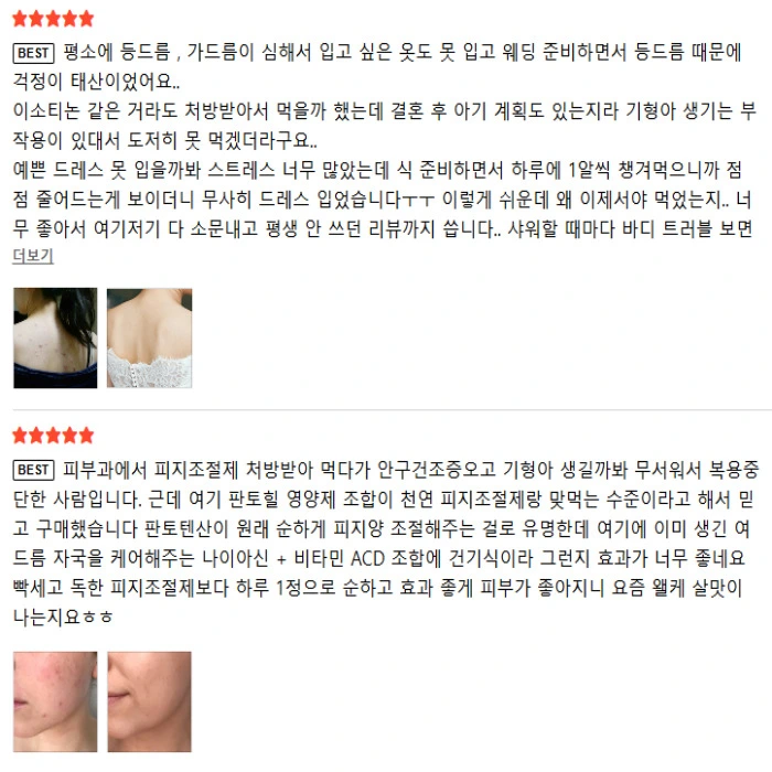 에보덤 판토힐 내돈내산 후기 부작용 효능 복용법 가격