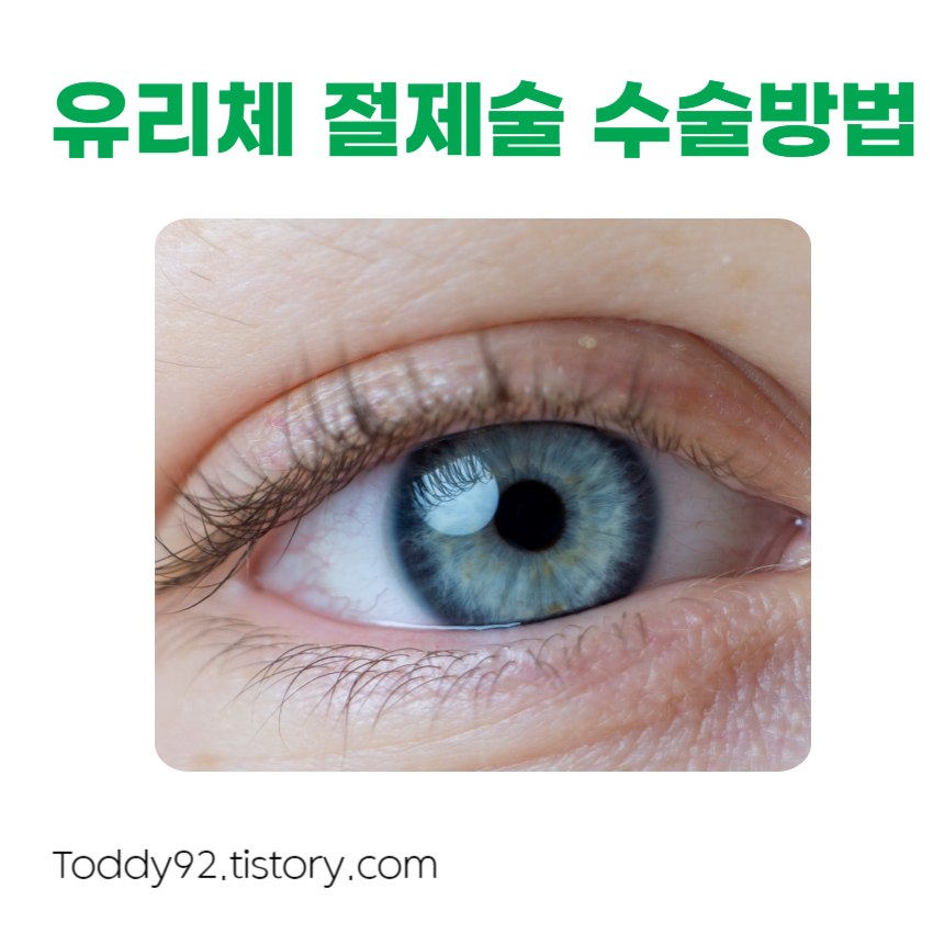 유리체절제술 수술 방법