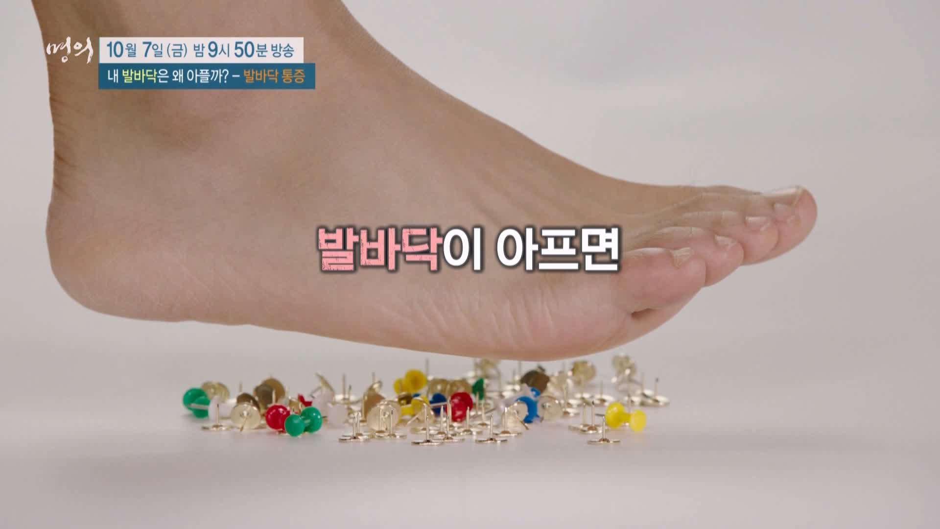 명의 족저근막염, 지간신경종, 무지외반증, 지방패드위축증후군 발바닥 통증 운동 치료