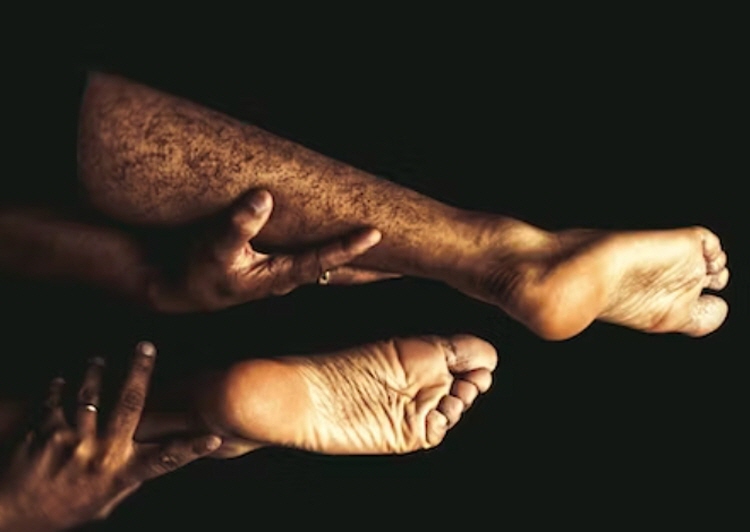 좌골신경통 증상