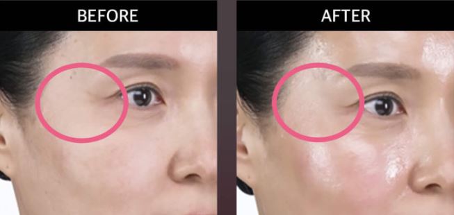 듀얼소닉-맥시멈-사용법