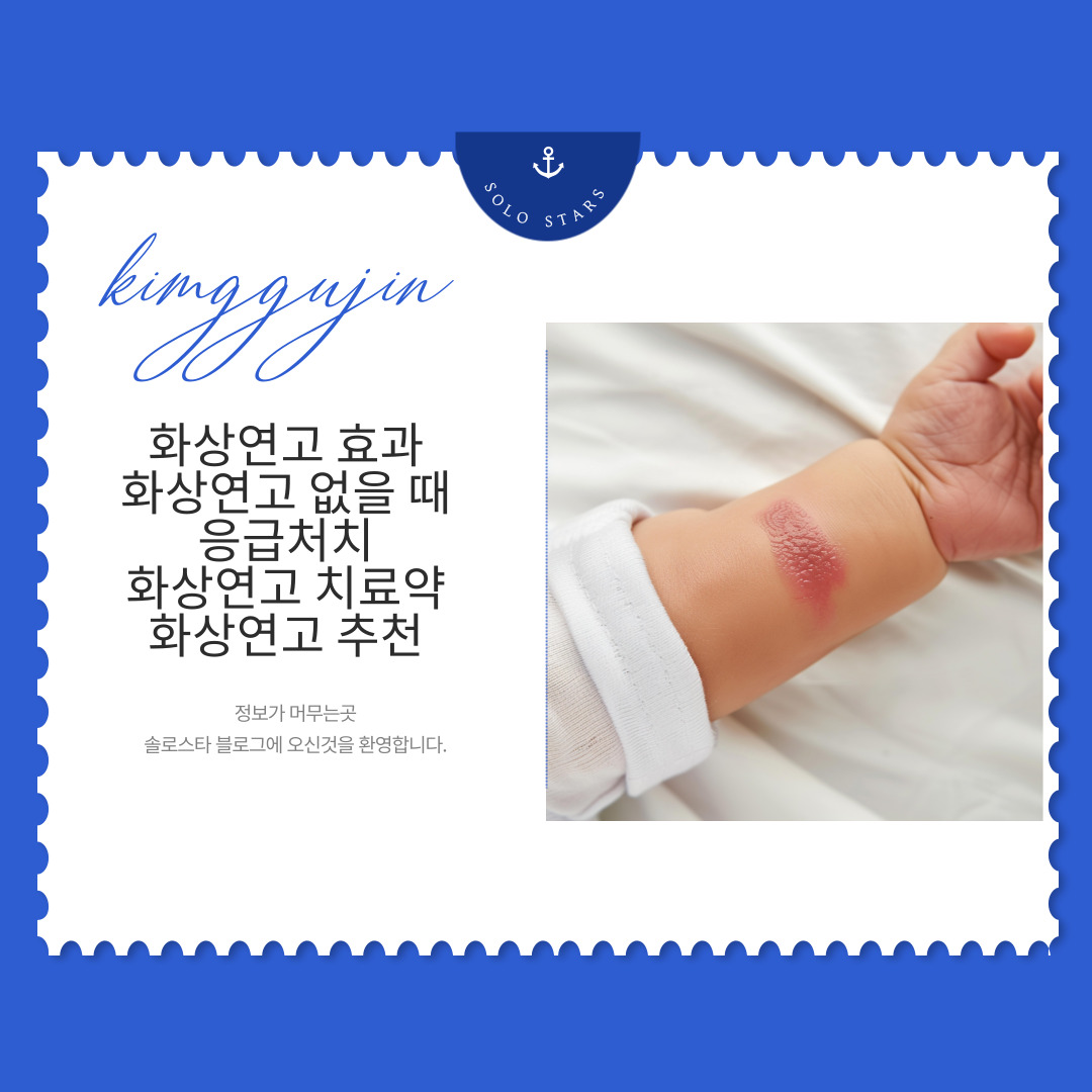 화상연고 관련 사진