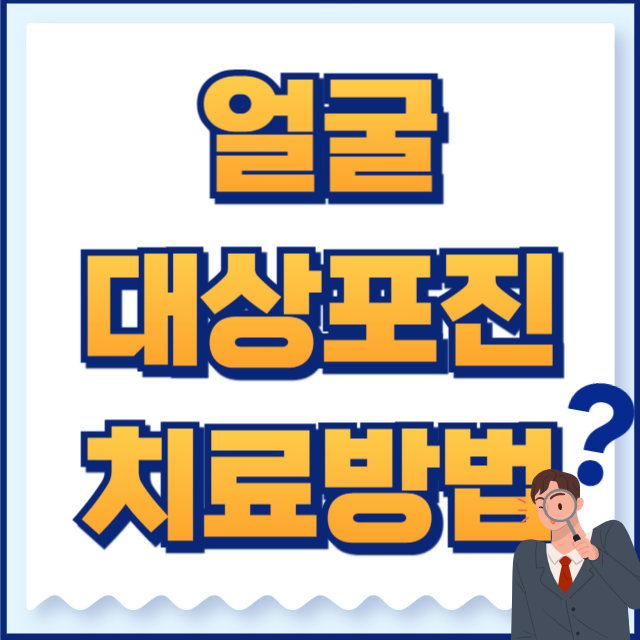 얼굴 대상포진