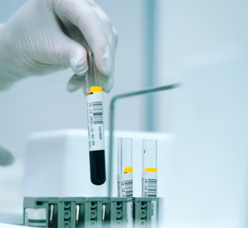 폐경기 전조증상 대처법