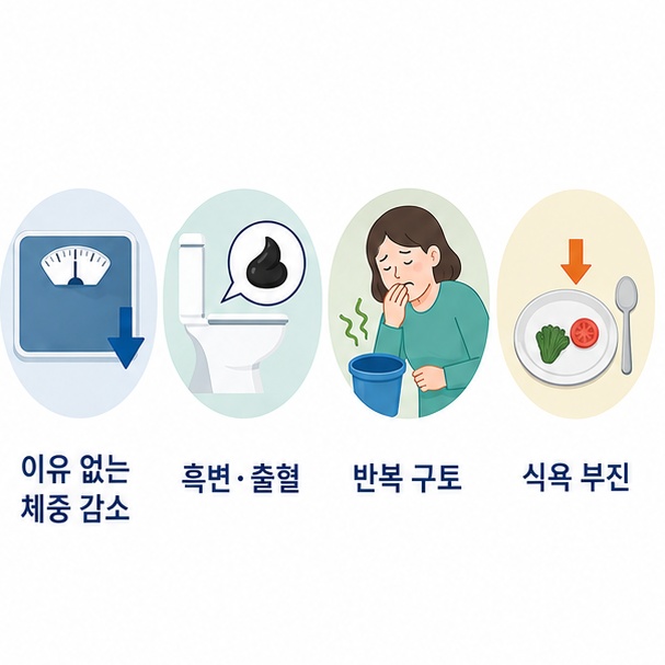 이유 없는 체중 감소와 흑변, 반복적인 구토 등 위축성 위염 환자가 주의해야 할 증상을 정리한 이미지