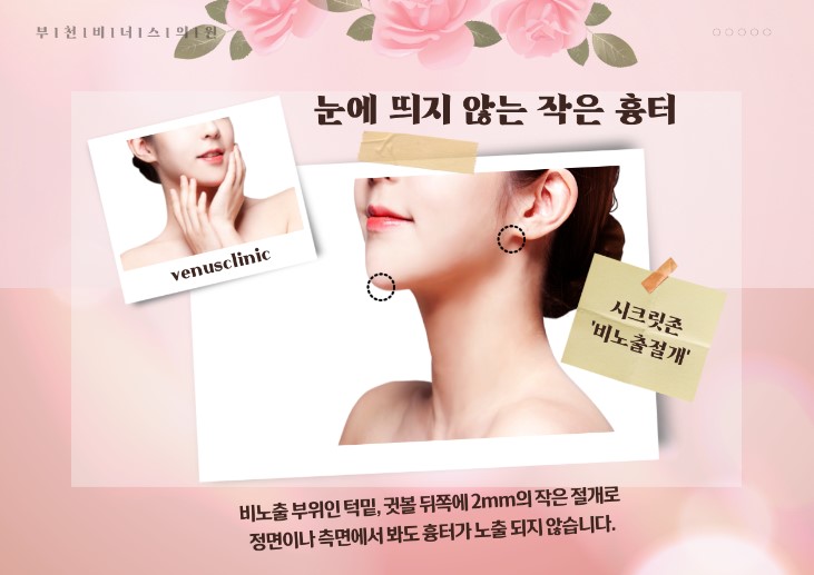 얼굴지방흡입 얼굴지방이식 안면윤곽수술 얼굴필러 얼굴보형물 얼굴성형 부작용 효과 붓기 멍 이중턱지방흡입