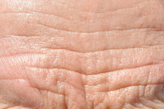 이마·눈가·팔자주름, 부위별 주름 시술 총정리