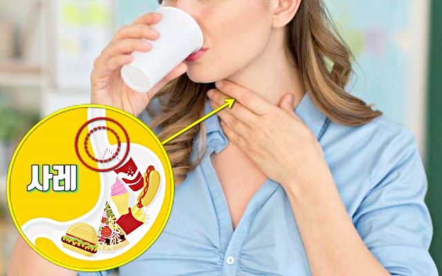 위암 초기 증상,삼킴장애,사레,건강 팁줌 매일꿀정보