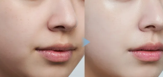 스킨 세팅 톤 밸런싱 베이스 (33,000원 / 40ml)