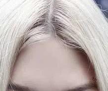 비문증 치료방법