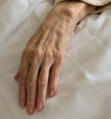 류마티스 관절염 초기증상 치료 원인 예방법