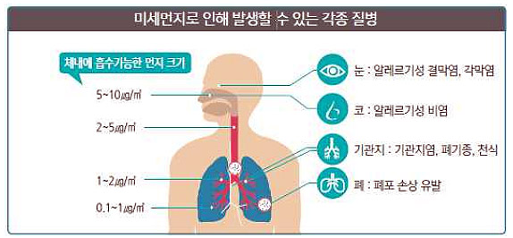 미세먼지 부작용