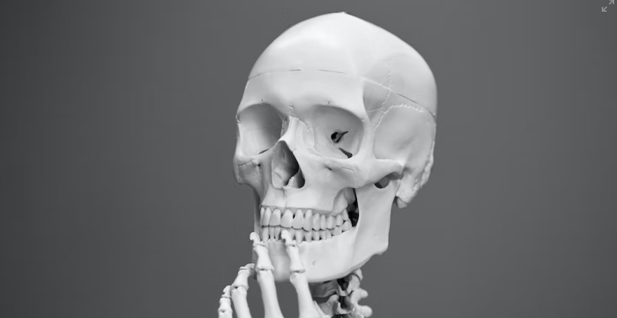 다른 질병과 관련된 안면마비