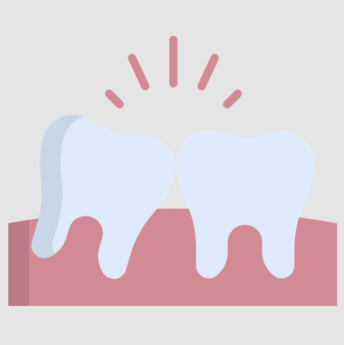 사랑니 발치 전 주의사항, 알아야 할 6가지 필수 사항