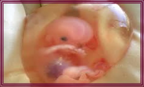 임신 중절 수술 시기