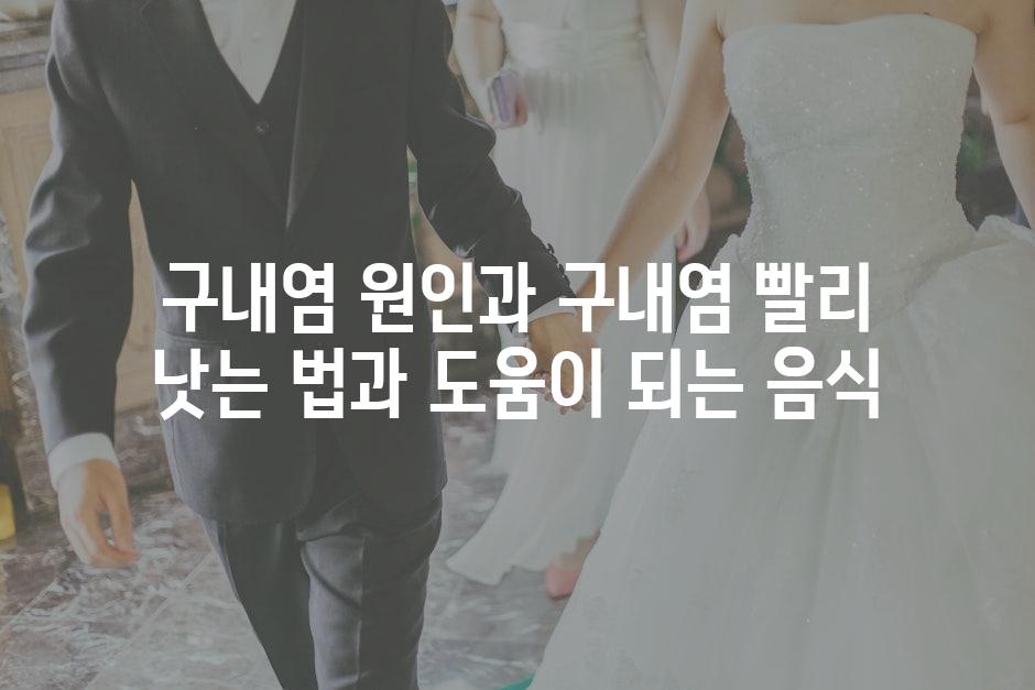 샘플 (70)