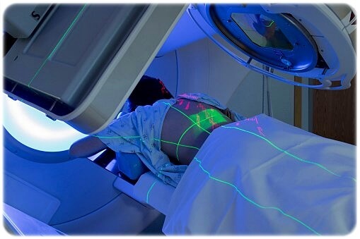 간암 초기증상 원인 진단 치료 예방 생존율