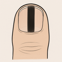 발톱이 검게 변하는 주요 원인들