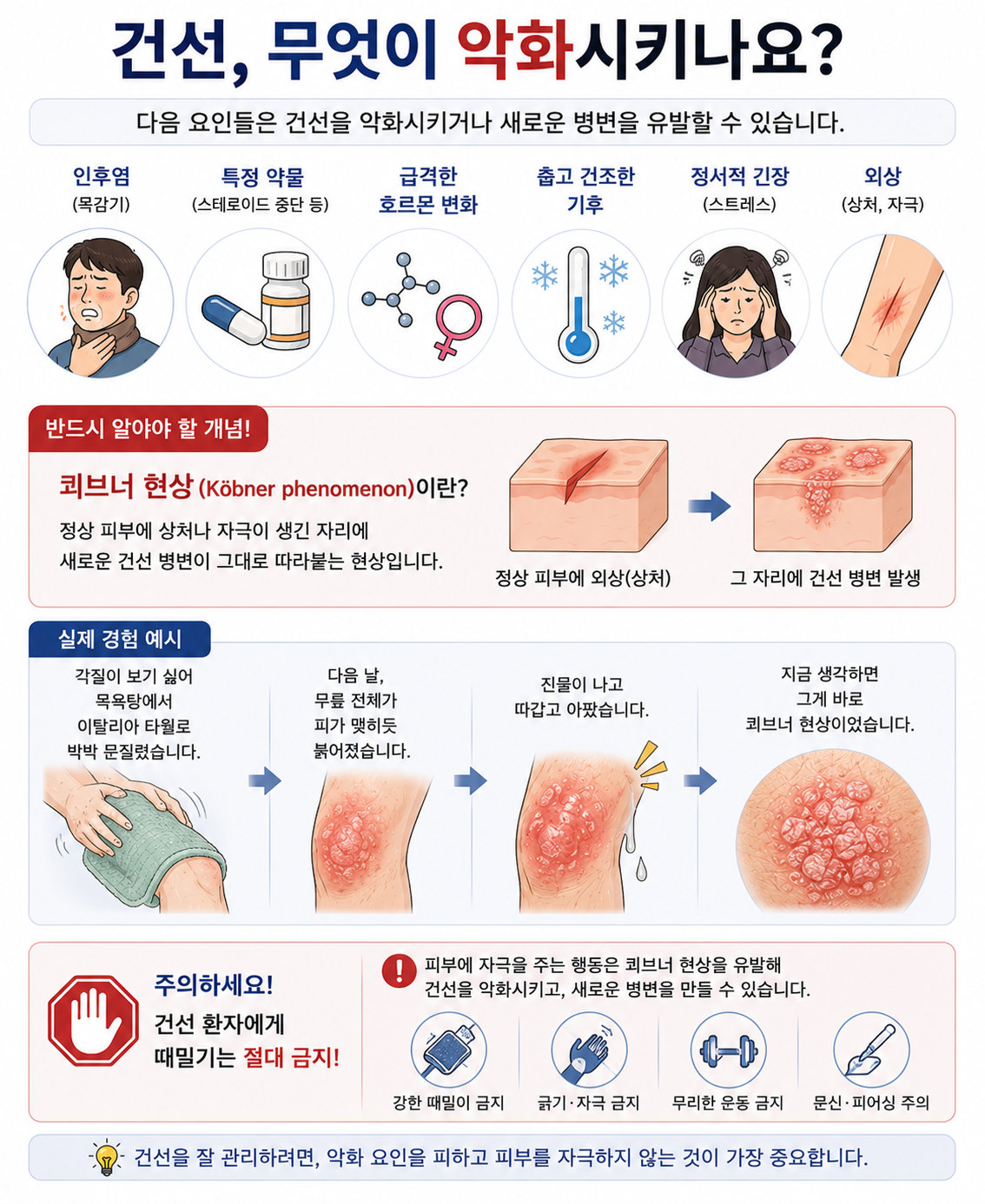 건선을 악화시키는 원인들