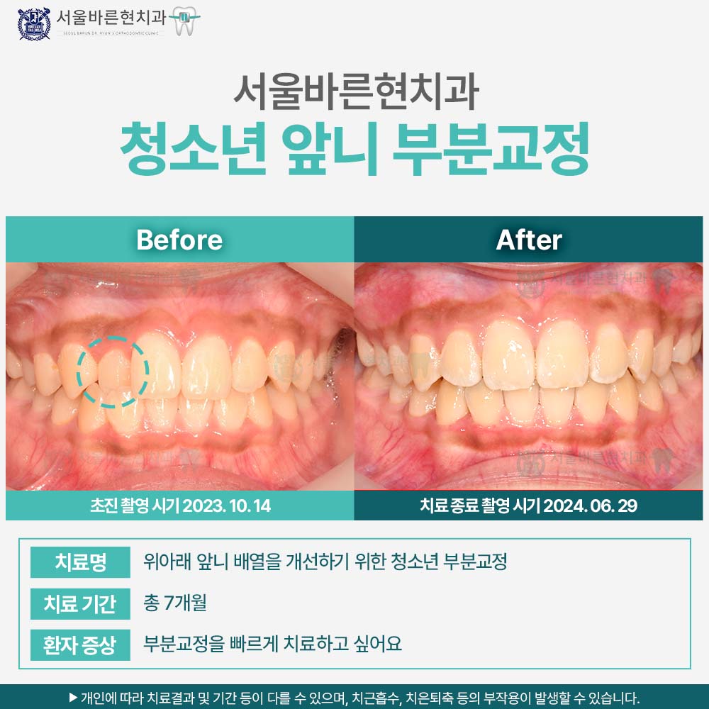 부산교정치과