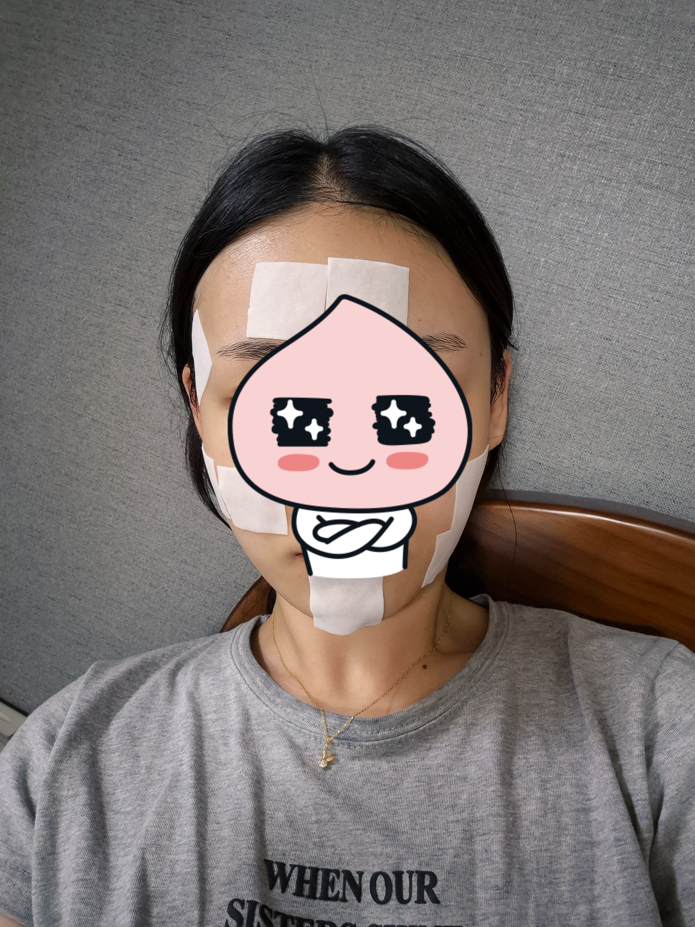 좁쌀패치 붙인 사진