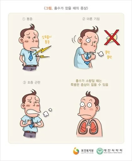 늑막에 물이 차는 이유와 치료 방법_6