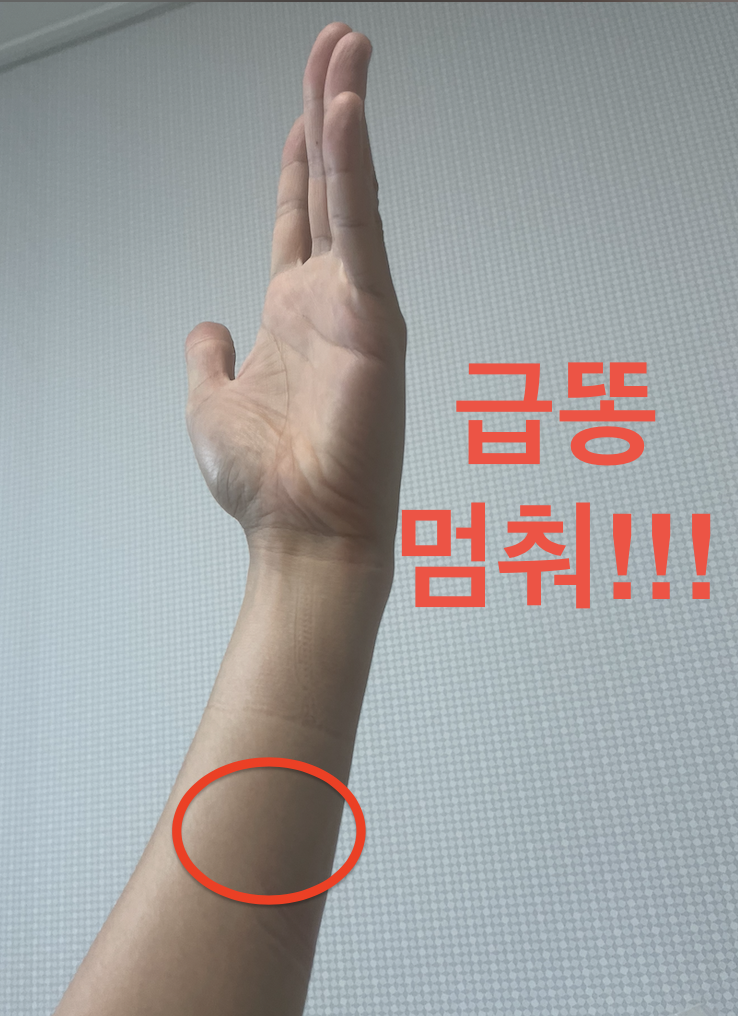 급똥 참는법