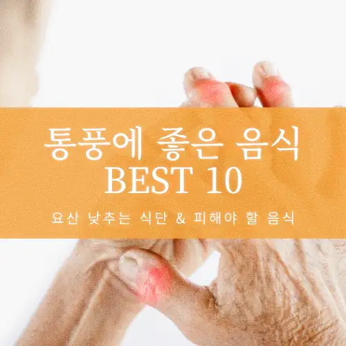 통풍에 좋은 음식 BEST 10