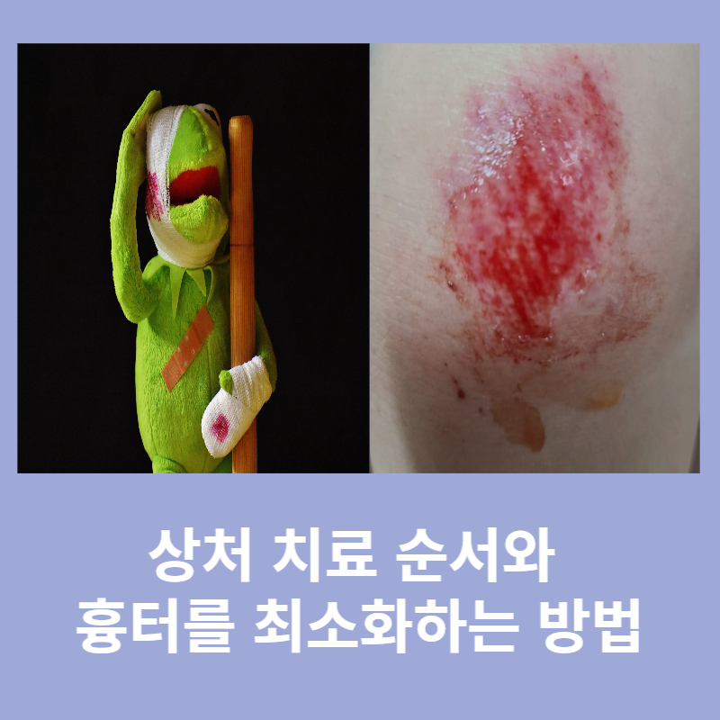 상처