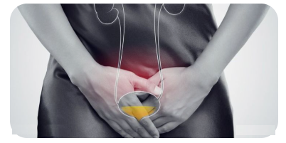 방광염-증상과-치료