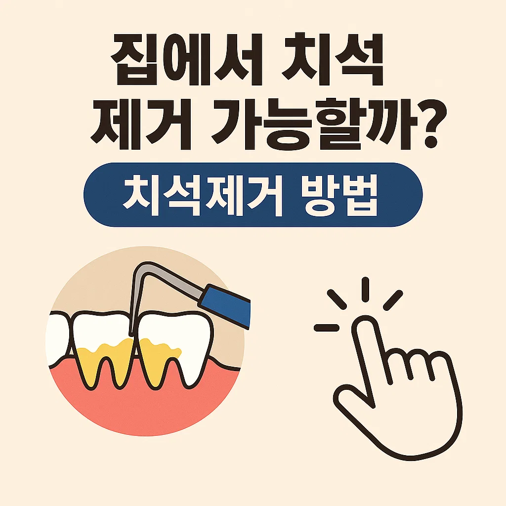 치과 안 가고 치석 제거 가능할까? 셀프 치석 제거 방법과 한계 분석