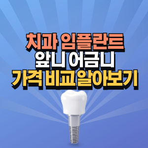 임플란트-앞니-어금니-가격-비교