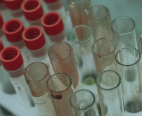 대상포진 치료방법 진단 기준 합병증