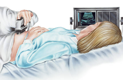 자궁근종 증상 크기별 치료 수술후 회복기간 등 알아보기(최신 Ver)