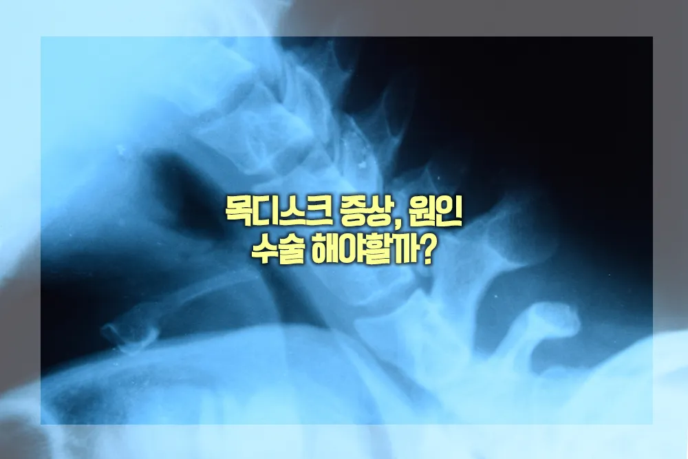 목디스크 증상 원인 수술
