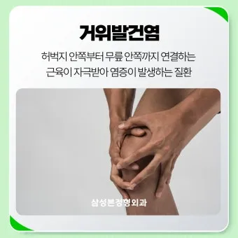 거위발 건염 원인과 증상 무릎 안쪽 통증 치료법 정리_16