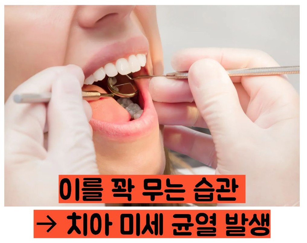 이빨이 시린 이유