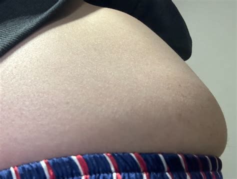 식욕억제제 완전 정리와 처방 받는 방법