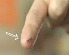 서울시 반려동물 내장형 마이크로칩