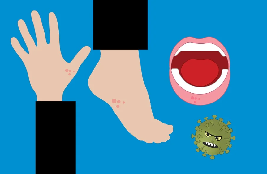 음식물-과민증-증상