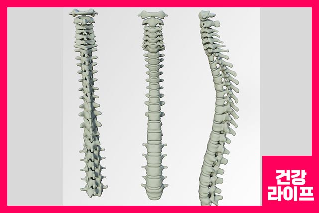 원인 - 퇴행성, 유전적, 직업, 환경적으로 발생