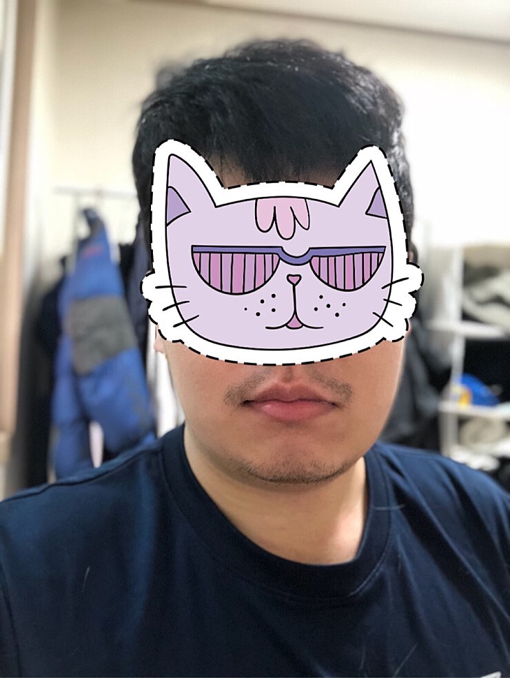 얼굴 지방흡입 후기