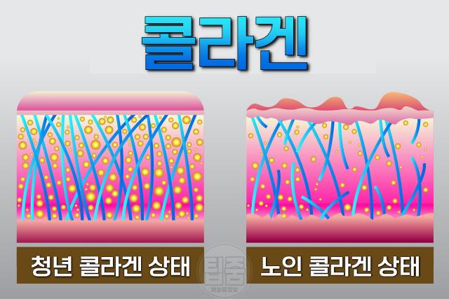 콜라겐 결핍증 부족증상