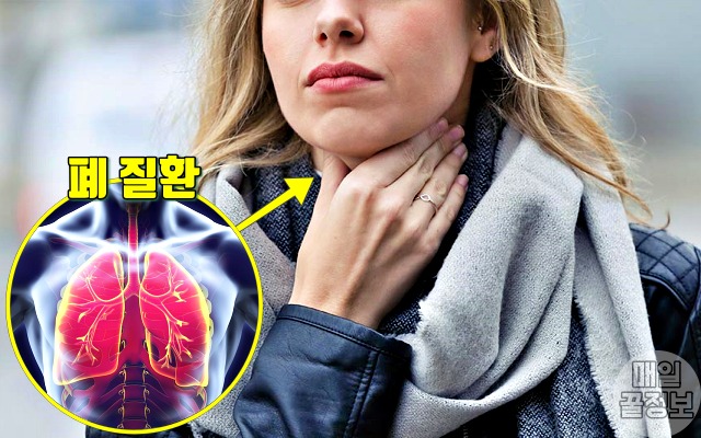 가래 색깔별 증상, 폐암 가래 색깔, 가래에 피가 섞여 나올때, 건강 팁줌 매일꿀정보